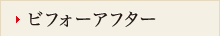ビフォーアフター